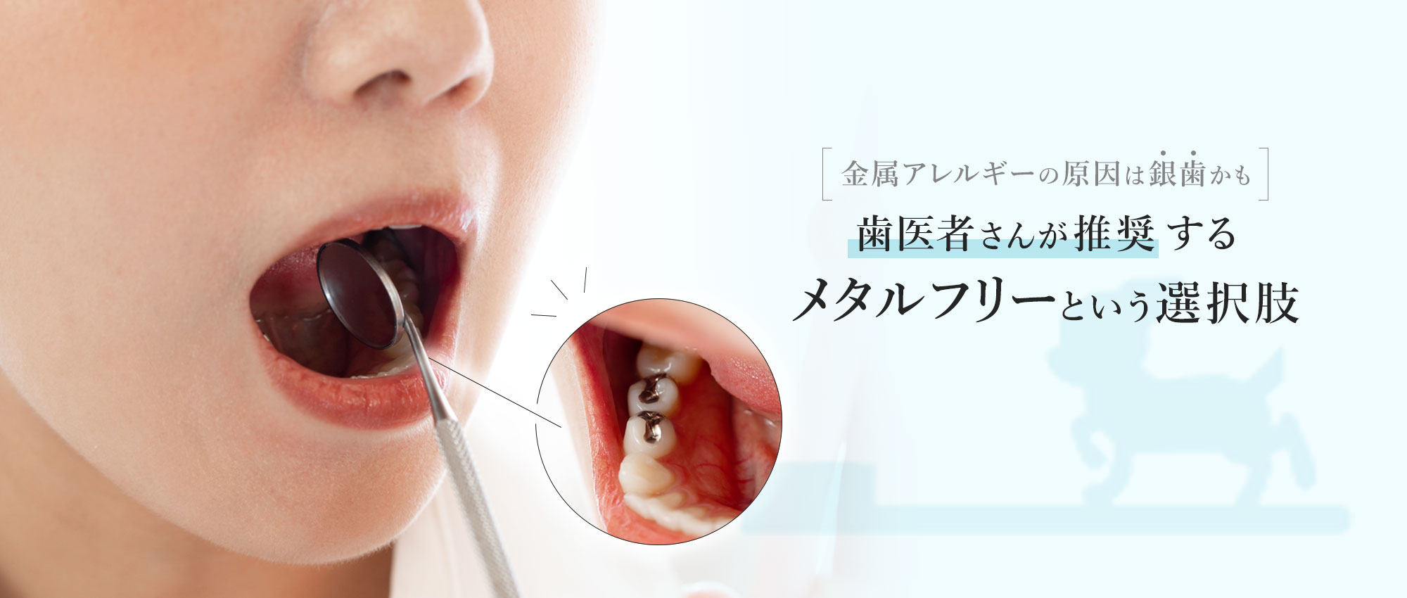 金属アレルギーの原因は銀歯かも。歯医者さんが推奨するメタフリーという選択肢